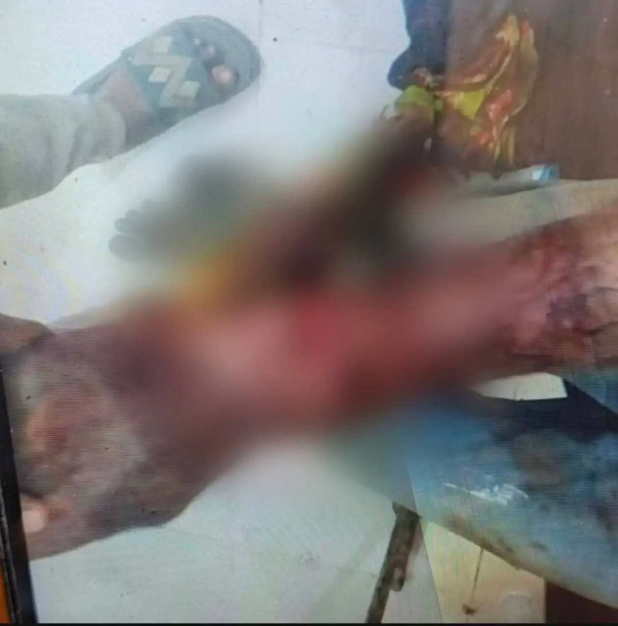 ব্রাহ্মণবাড়িয়া সদর দূবলা সড়কে ১০ বার ছুরিকাঘাত করে অটোরিকশা ছিনতাই, চালক আশঙ্কাজনক, হাসপাতালে ভর্তি!