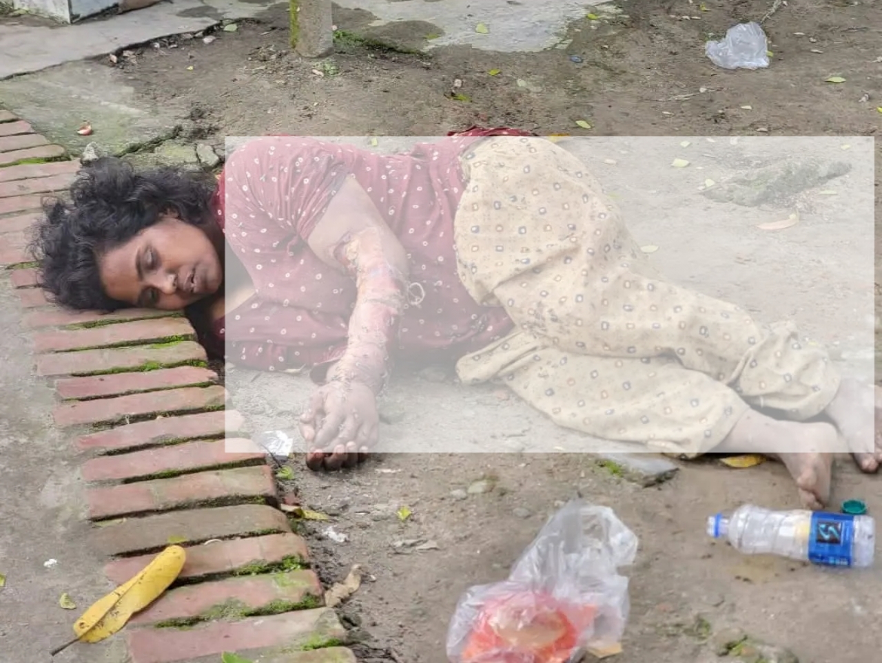 ক্ষত পঁচে দুর্গন্ধ,কাউনিয়ায় সড়ক দুর্ঘটনায় আহত অজ্ঞাত ভারসাম্যহীন মহিলা